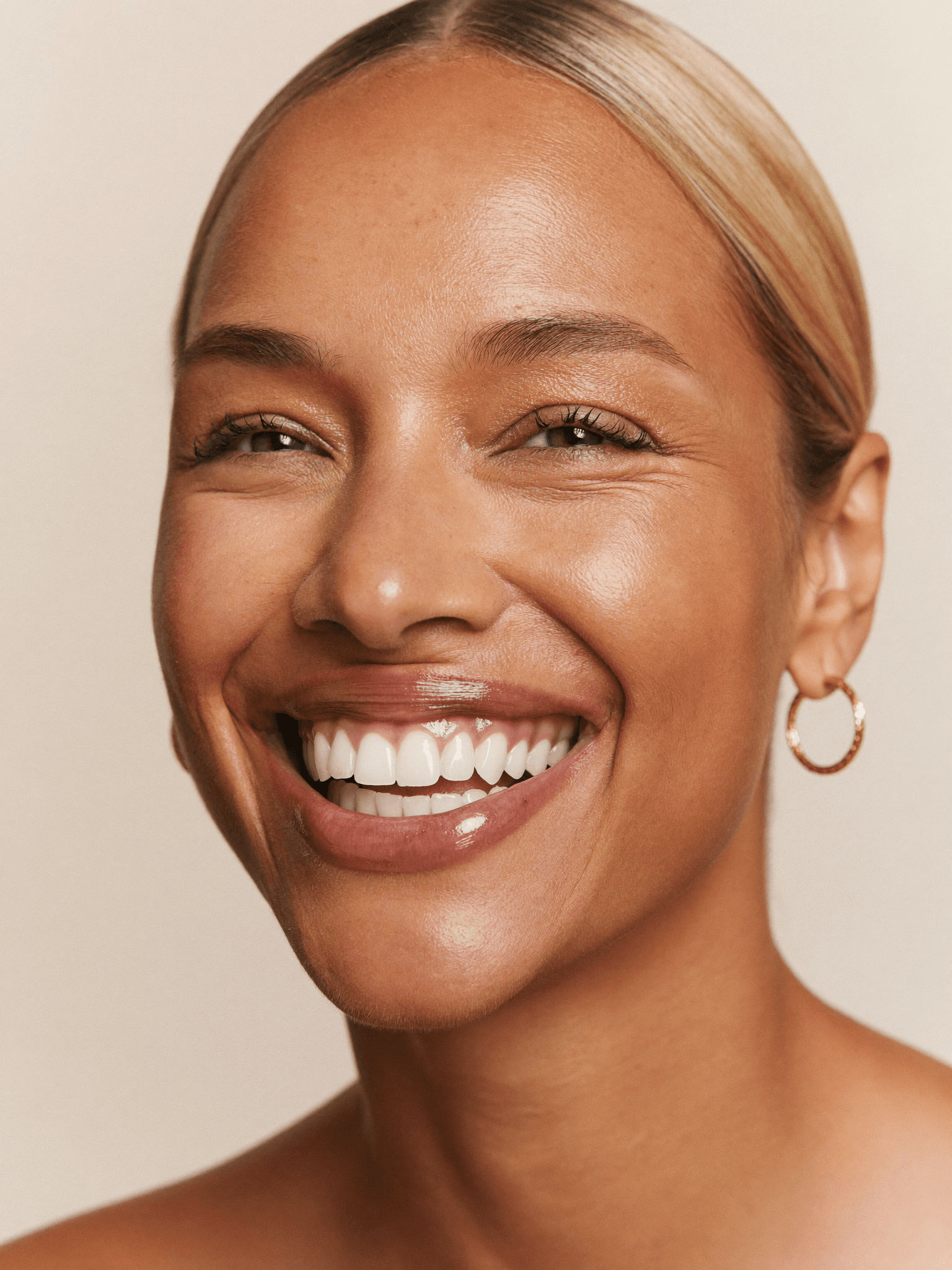Teeth whitening in Miami — radiant white smile with natural glow